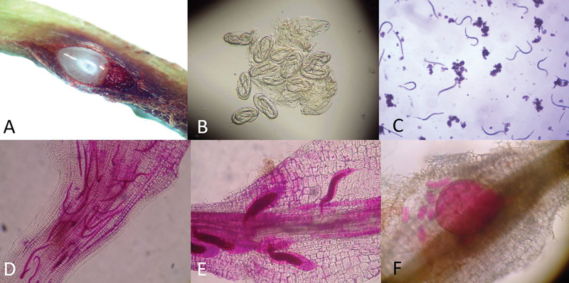 Root-knot nematode life cycle