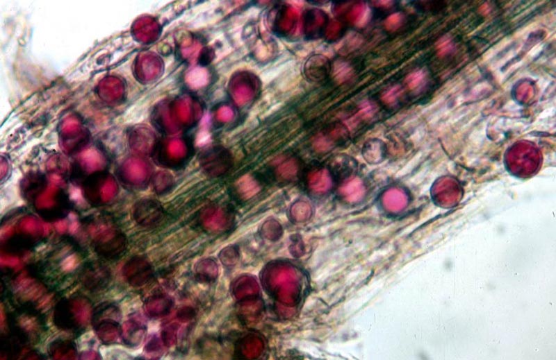Pythium oospores
